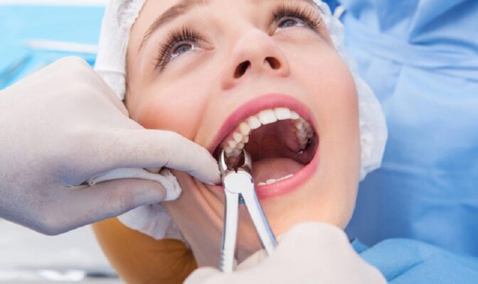 Địa chỉ nhổ răng khôn tại Thái Bình uy tín được khách hàng tin chọn