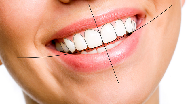 Quy trình thiết kế nụ cười Thái Bình của Nha Khoa Ngọc