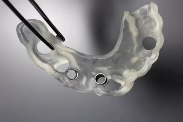 Những điều cần biết về trồng răng implant bằng máng hướng dẫn tại Thái Bình