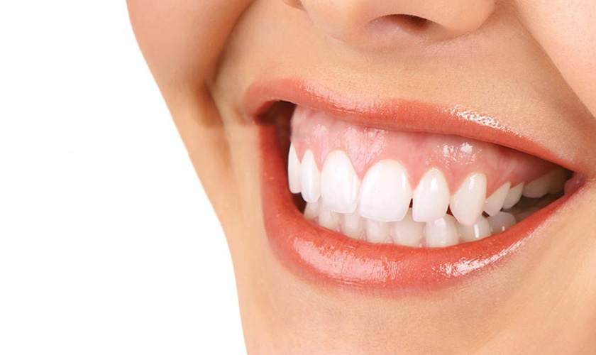 Yếu tố quyết định đến thành công và thẩm mỹ của nụ cười