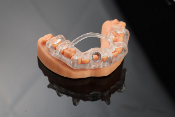 Quy trình sử dụng máng hướng dẫn phẫu thuật implant tại Thái Bình