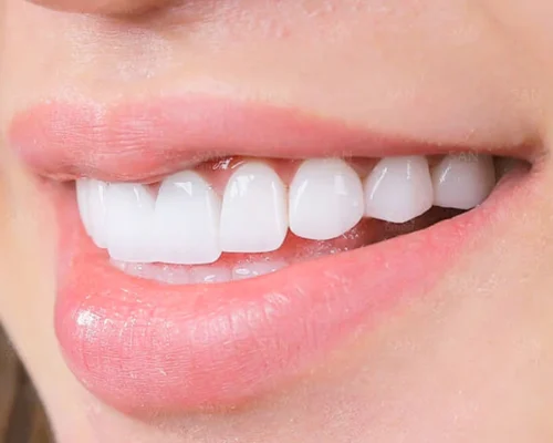 Ưu điểm của thiết kế nụ cười tại Thái Bình mang lại