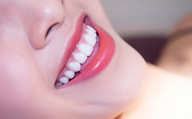 Những lưu ý cần thiết khi làm răng sứ thẩm mỹ tại Thái Bình