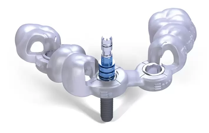 Địa chỉ trồng răng implant bằng máng hướng dẫn tại Thái Bình uy tín nhất