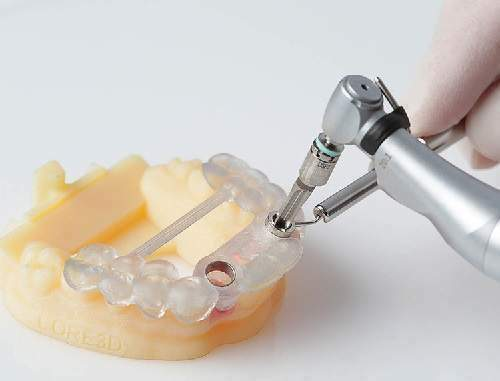 Nha Khoa Ngọc - Trồng răng implant bằng máng hướng dẫn tại Thái Bình