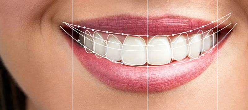 Dịch vụ thiết kế nụ cười Thái Bình uy tín, đảm bảo