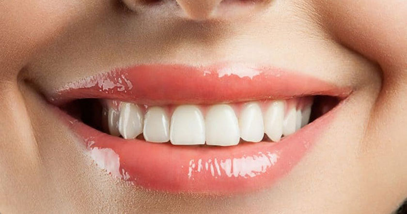 Răng sứ thẩm mỹ Thái Bình là một giải pháp phổ biến trong ngành nha khoa hiện nay