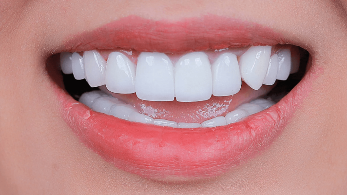 Tìm hiểu công nghệ thiết kế nụ cười Thái Bình