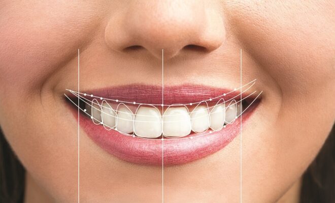 Những tiêu chí cần thiết khi thiết kế nụ cười Thái Bình