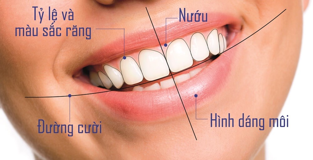 Công nghệ thiết kế nụ cười Thái Bình - Bước tiến mới trong nha khoa hiện đại