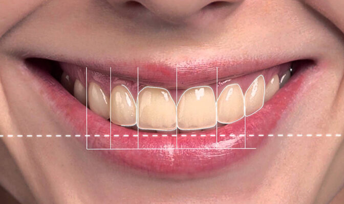 Thiết kế nụ cười Thái Bình