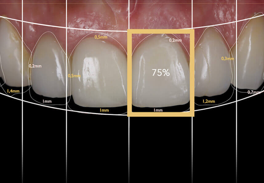 Thiết kế nụ cười Thái Bình 2 Lên kế hoạch thiết kế nụ cười Thái Bình