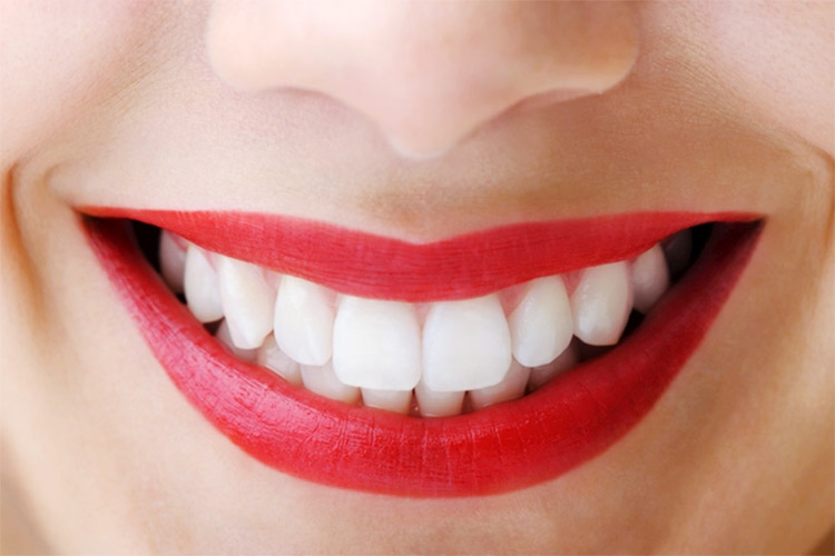 Tìm hiểu công nghệ thiết kế nụ cười Thái Bình 1 Tìm hiểu công nghệ thiết kế nụ cười