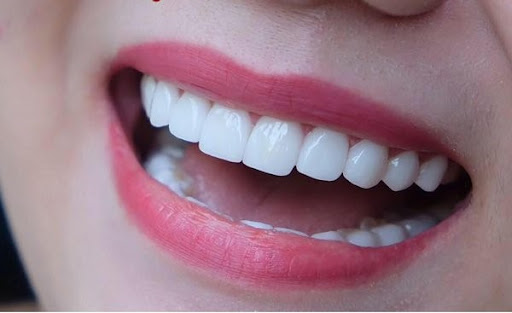 Răng sứ thẩm mỹ Thái Bình - Dịch vụ nha khoa mang đến hàm răng trắng và nụ cười tự tin