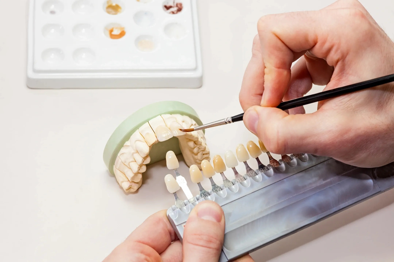 Quy trình sản xuất răng sứ chuẩn chất lượng