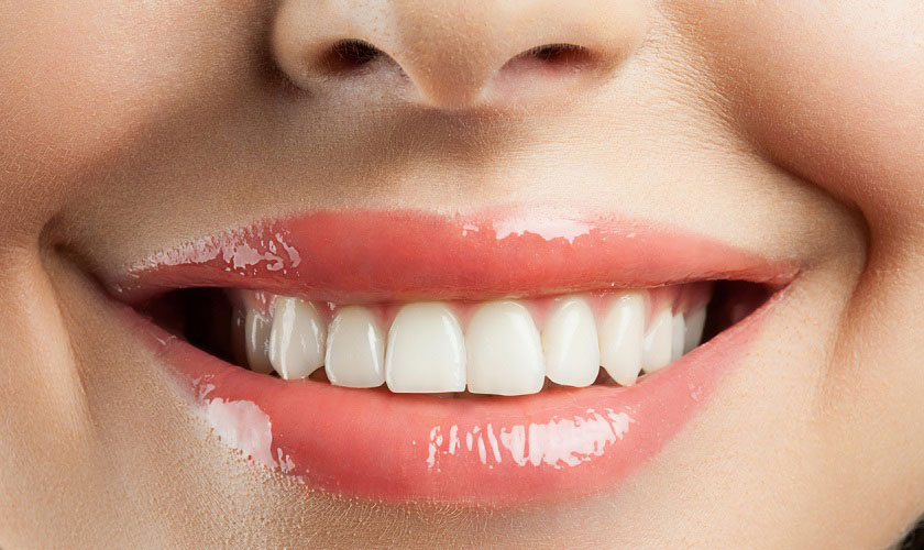 Tìm hiểu quy trình bọc răng sứ tại Thái Bình