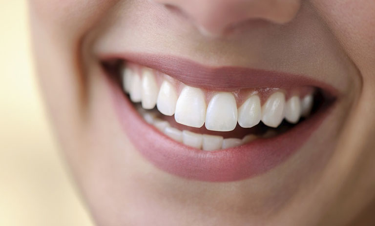 Ưu điểm của bọc răng sứ Thái Bình mang lại