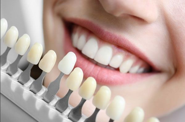 Kinh nghiệm chọn địa chỉ bọc răng sứ Thái Bình uy tín