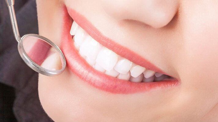 labo sản xuất răng sứ Thái Bình