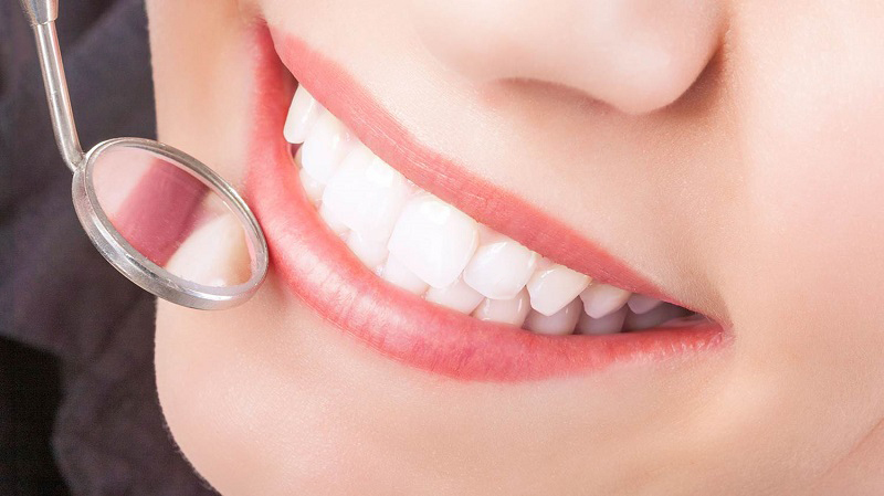 labo sản xuất răng sứ Thái Bình