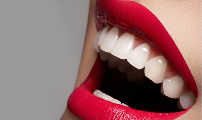 rang su la gi can chu y dieu gi khi boc rang su