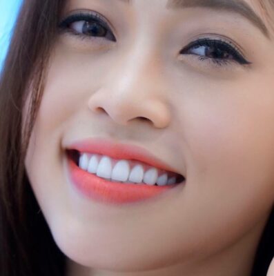 bọc răng sứ Thái Bình