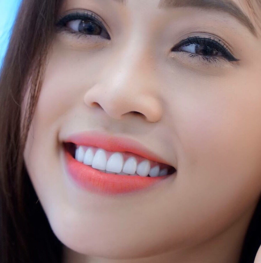 bọc răng sứ Thái Bình