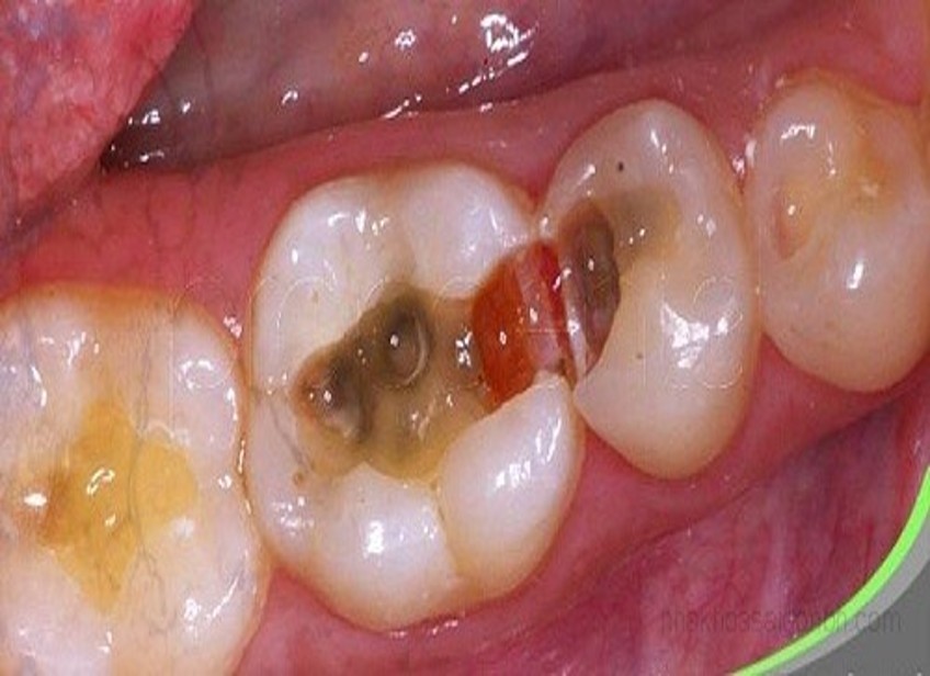 Picture1