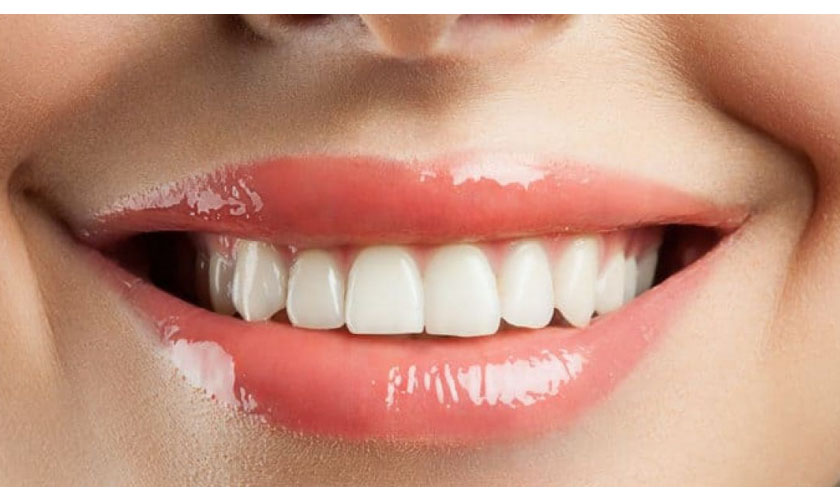 Ưu điểm khi hàn răng cửa bị mẻ Thái Bình