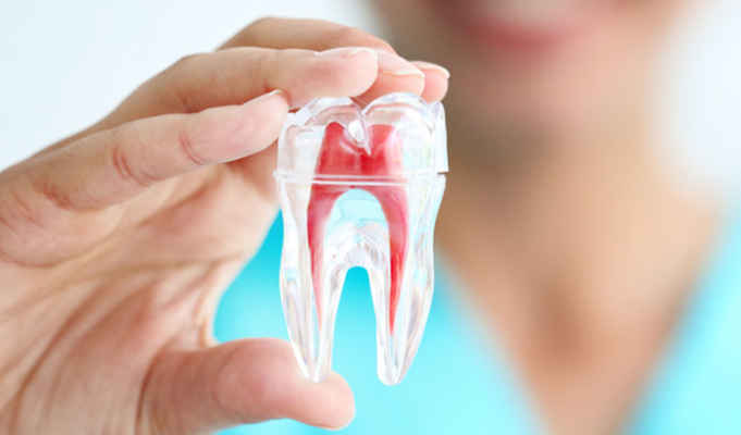Điều trị tủy bọc răng sứ Những điều bạn cần biết trước khi thực hiện