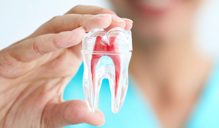 Điều trị tủy bọc răng sứ Những điều bạn cần biết trước khi thực hiện