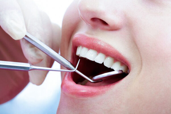 Hàn răng thẩm mỹ Hưng Yên Giải pháp phục hồi nụ cười đẹp tự nhiên