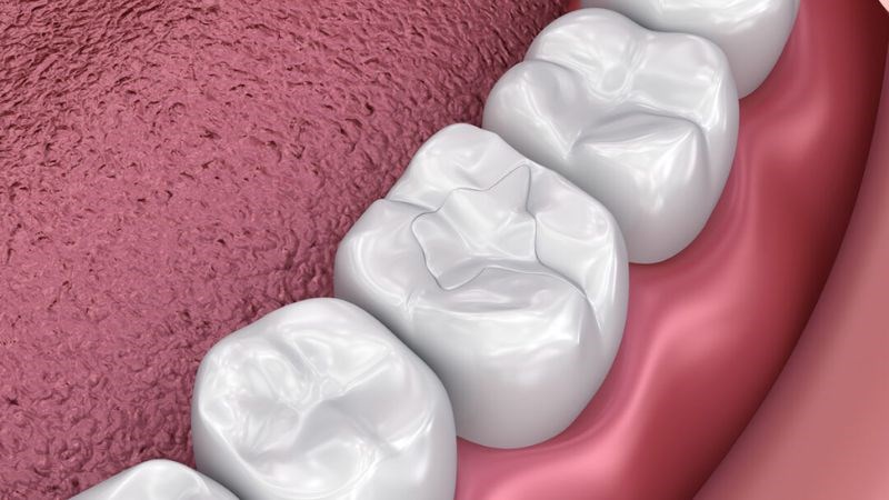 Nha Khoa Ngọc địa chỉ hàn răng thẩm mỹ Thái Bình uy tín
