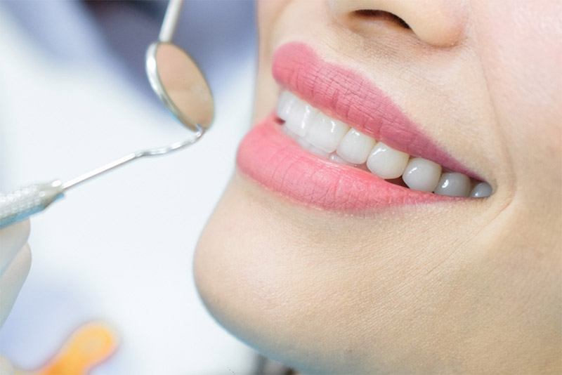 Quy trình hàn răng thẩm mỹ tại Hưng Yên
