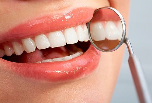 Top 5 ưu điểm nổi bật của hàn răng thẩm mỹ Thái Bình