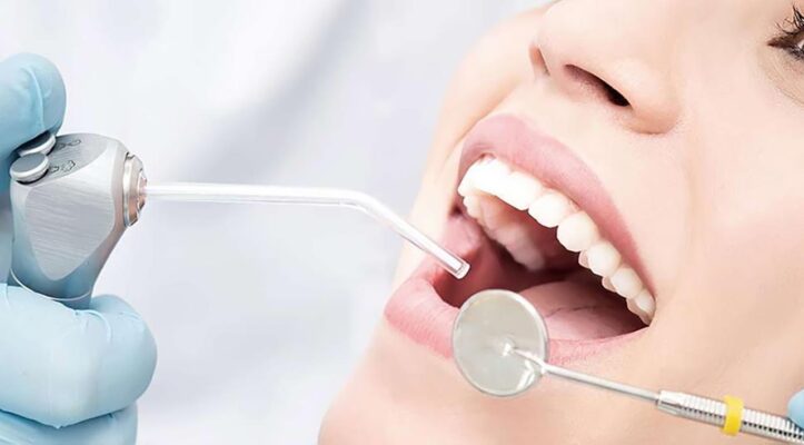 Ưu điểm của hàn răng thẩm mỹ