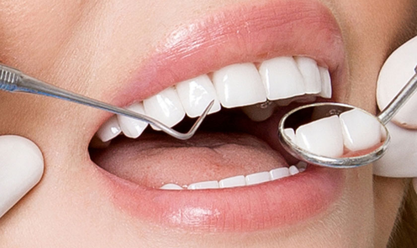 Lựa chọn nha khoa uy tín để thực hiện bọc răng sứ là 1 trong những bí quyết phòng ngừa viêm lợi răng sứ an toàn và bền lâu
