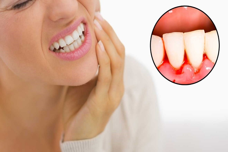 Viêm lợi răng sứ khám ở đâu? Tiêu chí lựa chọn nha khoa uy tín để khám viêm lợi răng sứ