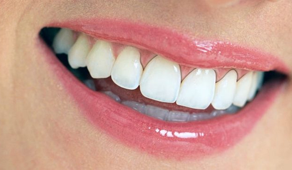 Viêm lợi sau bọc răng sứ Dấu hiệu nhận biết sớm và cách xử lý kịp thời