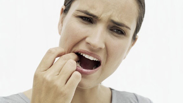 Điều trị răng sứ bị dắt thức ăn – Giải pháp cứu cánh cho người làm răng sứ lâu năm