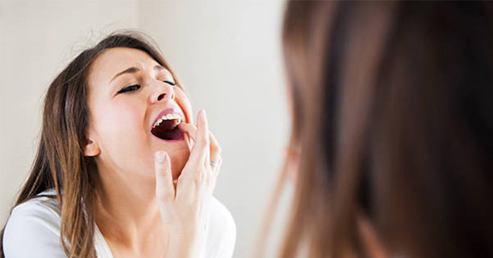 3 sai lầm khiến viêm lợi răng sứ đau nhức khó chịu 2 Lắp răng sứ không đúng kỹ thuật