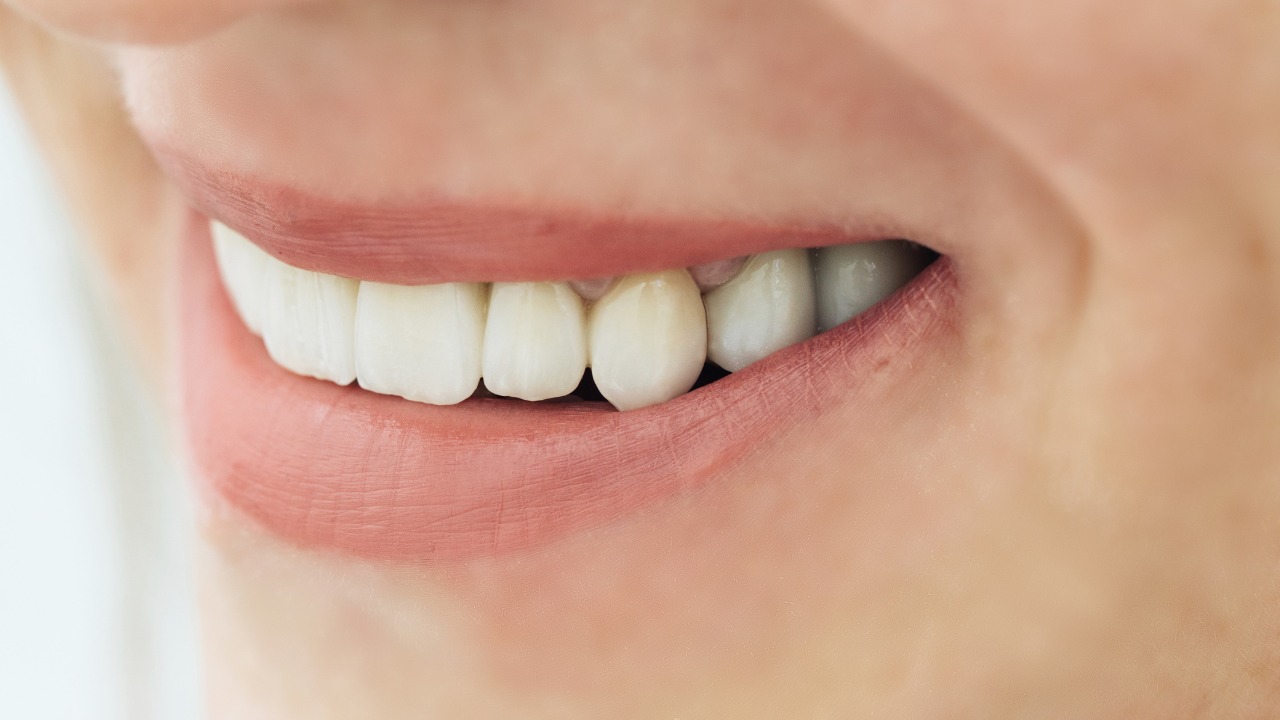 Viêm lợi răng sứ có mủ: Dấu hiệu nhận biết sớm và cách chữa hiệu quả 3 Tìm hiểu nguyên nhân và tìm các điều trị răng sứ bị viêm hiệu quả