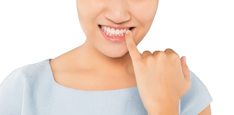 Chi phí xử lý răng sứ bị dắt thức ăn Khi nào cần điều trị và cần chuẩn bị bao nhiêu