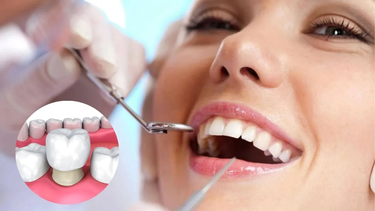 Địa chỉ uy tín điều trị răng sứ bị dắt thức ăn Hưng Yên 3 Dịch vụ điều trị răng sứ dắt thức ăn tại Nha Khoa Ngọc