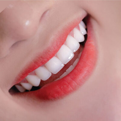 nha khoa chingo 13 768x768 1