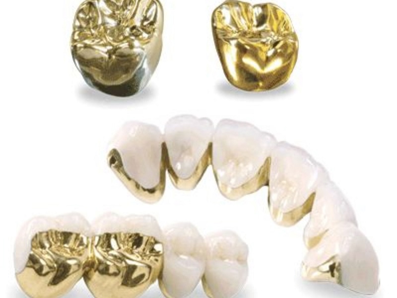 Răng sứ giá tốt nhất hiện nay là bao nhiêu? Cách chọn loại phù hợp 4 Răng sứ giá tốt nhất hiện nay là bao nhiêu? Cách chọn loại phù hợp