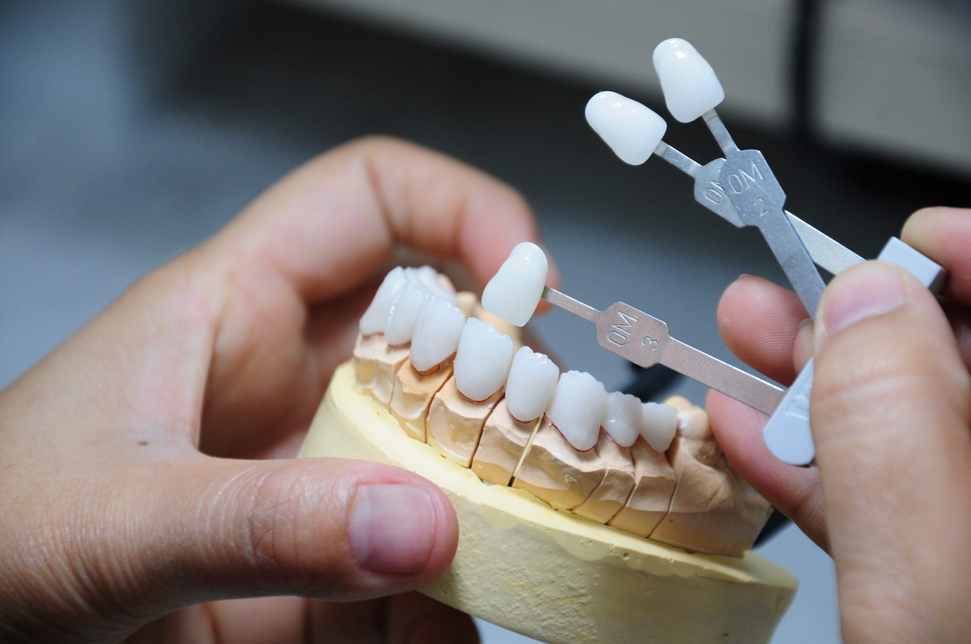Labo răng sứ nhận gia công răng sứ - Bí quyết tạo nên hàm răng tự nhiên như thật