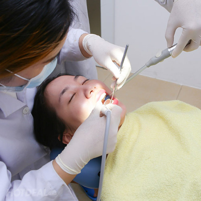 Labo răng sứ làm cercon chuẩn đức – Độ bền và thẩm mỹ vượt trội