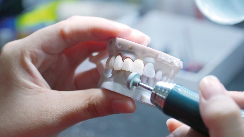 Labo răng sứ chất lượng cao – Giải pháp hoàn hảo cho nụ cười bền đẹp