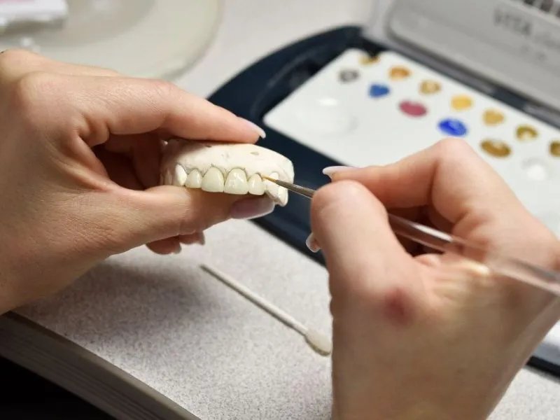 Địa chỉ labo răng sứ uy tín, chất lượng cao, giá hợp lý